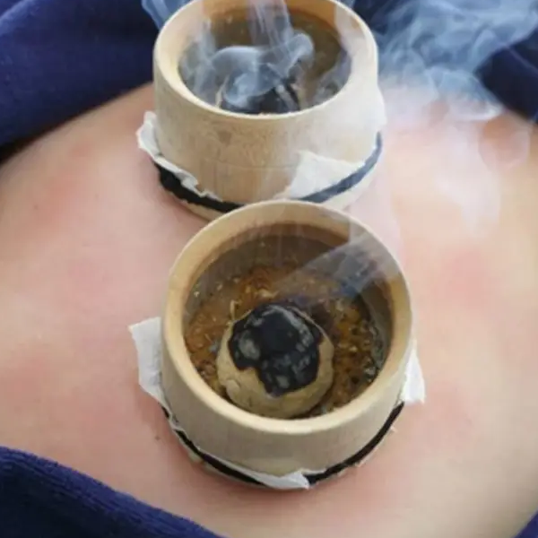 裹药熏蒸排寒祛湿温肾暖宫